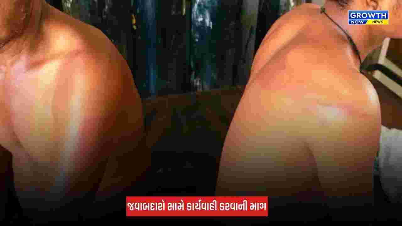 Aravalli : માલપુર ફોરેસ્ટ કચેરીમાં મારપીટના ગંભીર આક્ષેપો, નિષ્પક્ષ તપાસની માગ