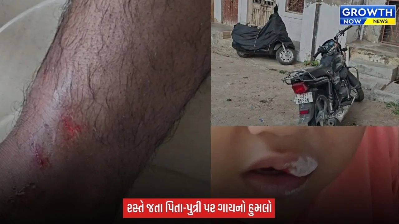 Arvalli : મોડાસામાં રખડતા ઢોરનો ત્રાસ, ગાયે પિતા-પુત્રી પર હુમલો કરતા થયા ઈજાગ્રસ્ત